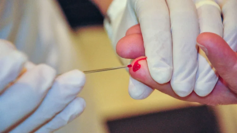 hepatites-virais-causam-mais-de-milenio-mortes-em-2024-no-brasil