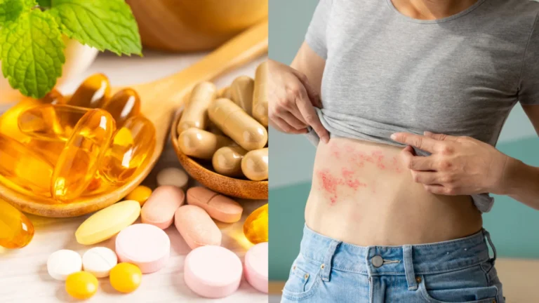 overdose-de-vitaminas:-perigos-e-efeitos-colaterais-de-toma-las-em-sobra!