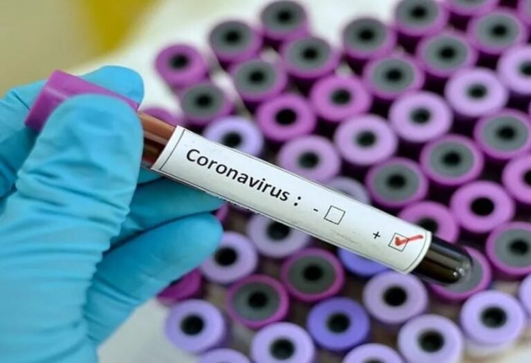 Amazonas apresenta aumento de síndrome respiratória por Covid-19, aponta Fiocruz