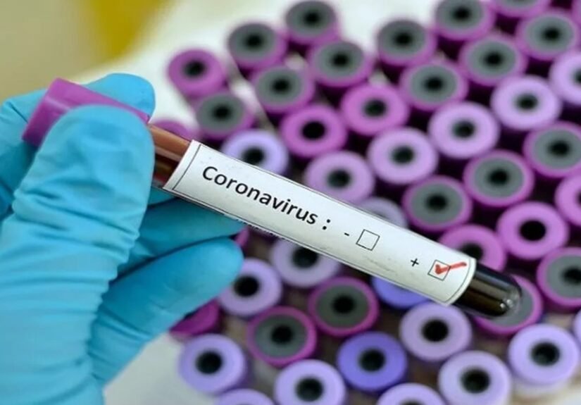 Amazonas apresenta aumento de síndrome respiratória por Covid-19, aponta Fiocruz