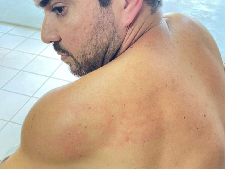 Vereador é acusado de dar tapa nas costas de colega dentro da Câmara no AC: 'Veio para cima de mim'