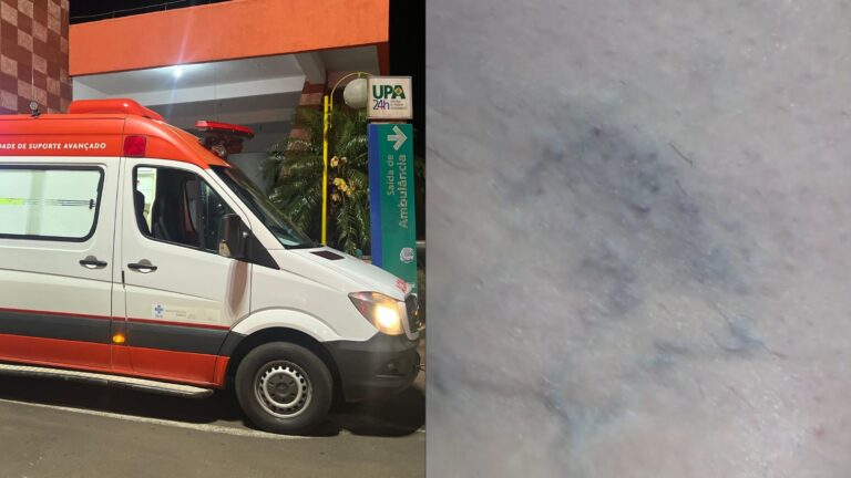 'Se fosse uma faca, eu estaria morta', diz técnica do Samu agredida com barra de ferro durante atendimento em casa noturna no Paraná
